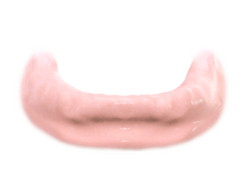 Implantes dentales. Clínica Dental Fernández León